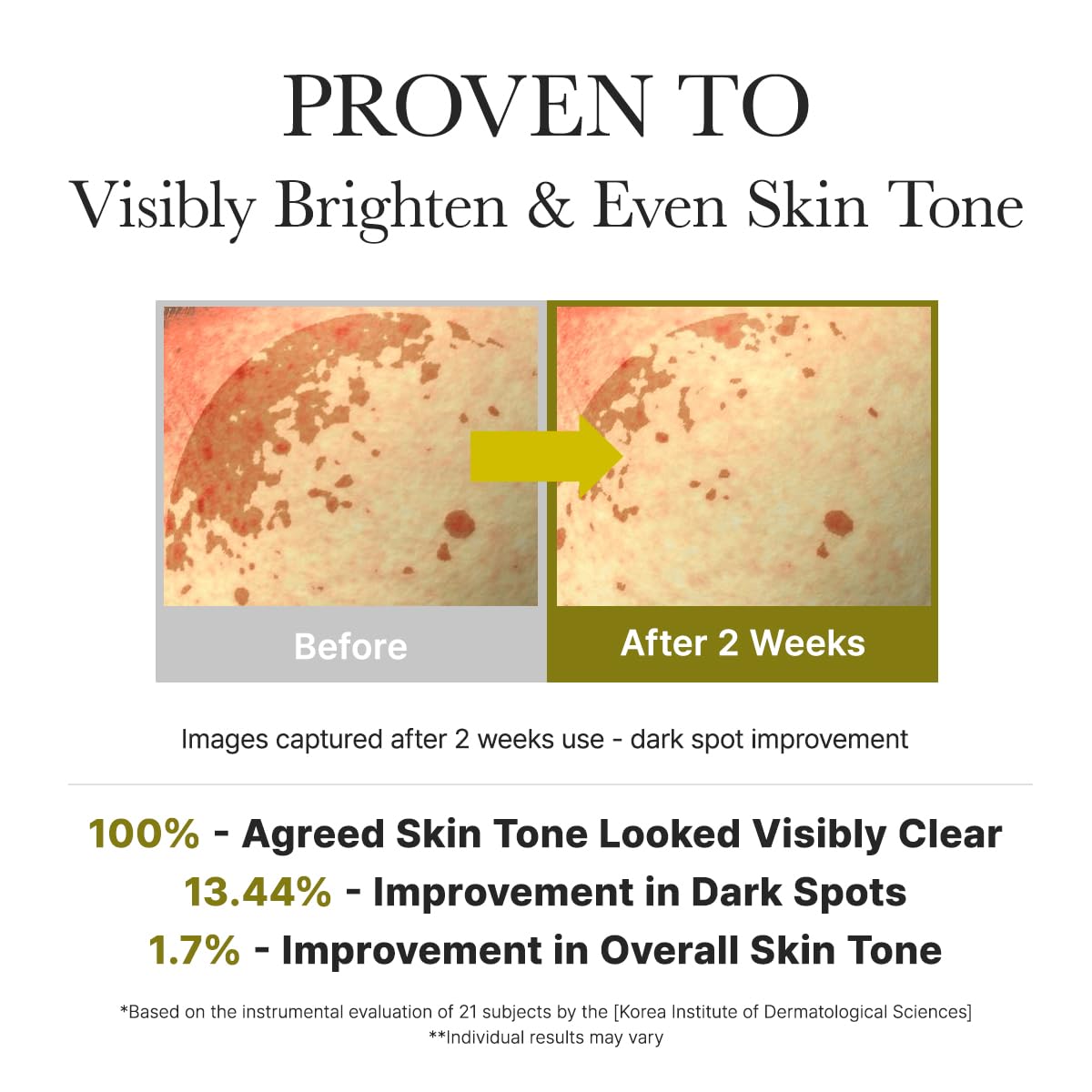 ARENCIA Vitamin C Booster Shot Serum with Glutathione, Niacinamide and Vitamin E for Dark Spot